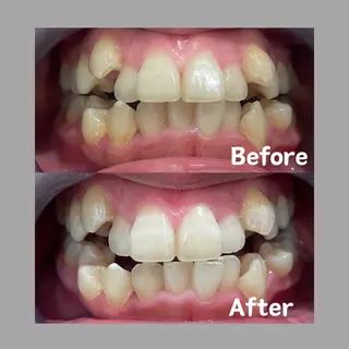 Kaula所属・Kaula ホワイトニング耳ツボのその他イメージ