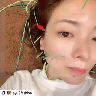 メンズ 美容鍼灸サロン LOMIHARIのエステ・リラクイメージ