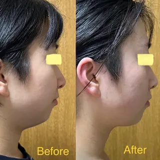 池袋【温活・痩身】 最新型よもぎ蒸しのエステ・リラクイメージ