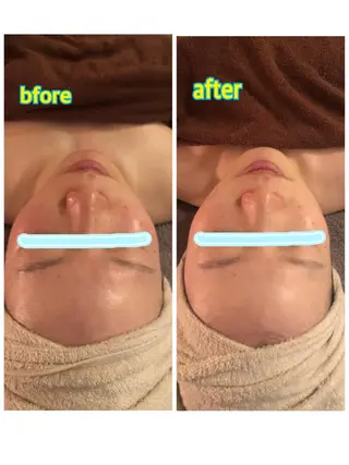 ペリドットラボ naoのエステ・リラクイメージ