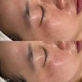 デ・アイム心斎橋所属・肌質改善サロン🫧 MAIのエステ・リラクイメージ