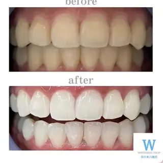 メンズ ホワイトニング ショップ本八幡店のエステ・リラクイメージ