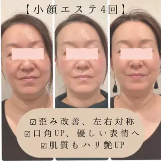 小顔×肌質改善サロン soin〔ソワン〕のエステ・リラクイメージ