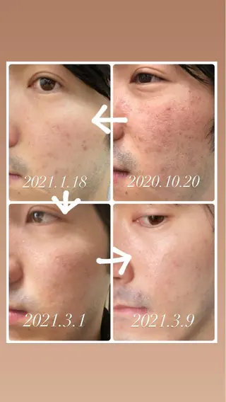 Relama 美容鍼×マッサージ所属・Relama/リラマ 美容鍼×マッサージのエステ・リラクイメージ