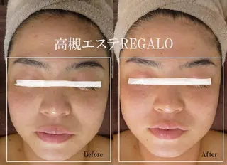 REGALO所属・矢野 さやかのエステ・リラクイメージ