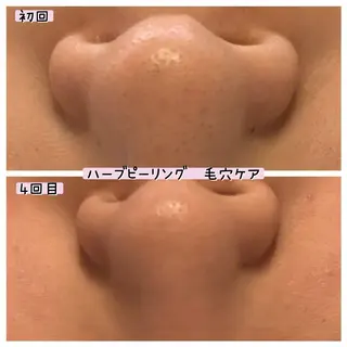 ぱんだ王国エステ所属・ぱんだ王国 エステのエステ・リラクイメージ