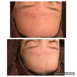 ロング カラー パーマ ヘアアレンジ メンズ キッズ ネイル マツエク・マツパ 四つ星サロン🎖 腸＆ニキビケアに特化のエステ・リラクイメージ