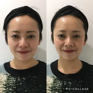 ミディアム 小顔矯正/美容整体 /骨盤矯正✨+Mi2のエステ・リラクイメージ