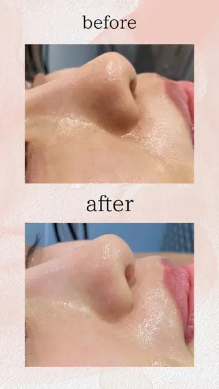 肌質改善専門サロン Bellmi/心斎橋のエステ・リラクイメージ