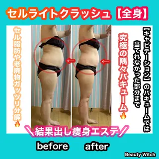 痩身/脱毛/ネイル HARUKAのエステ・リラクイメージ