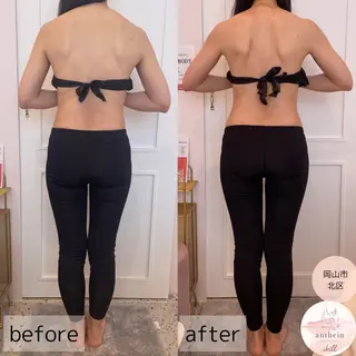 アンテインチル 山本のエステ・リラクイメージ