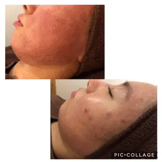 ミディアム カラー パーマ ヘアアレンジ メンズ キッズ ネイル マツエク・マツパ 四つ星サロン🎖 腸＆ニキビケアに特化のエステ・リラクイメージ