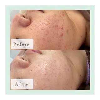 ホワイトニング専門店 御殿山/吉祥寺店のその他イメージ