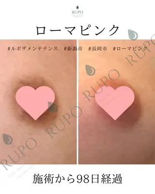 医療提携認定サロン　RUPO THE MAINTENANCE新潟店【ローマピンク/ララピール】所属・オーナー Nanjoのエステ・リラクイメージ