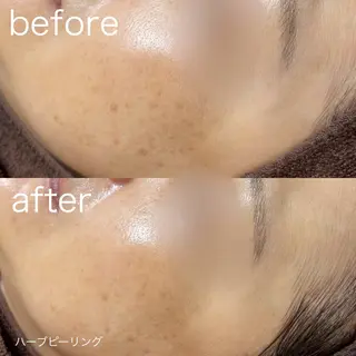 lulularico Yuのエステ・リラクイメージ