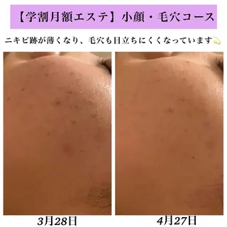 Bellesthe (ベルエステ)のエステ・リラクイメージ