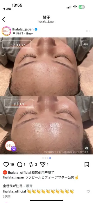 YUIITSU所属・YUIITSU 唯一のエステ・リラクイメージ