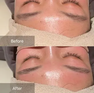 アイブロウ for woman所属・森 美優のエステ・リラクイメージ