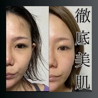 LiZA エステティックサロンのエステ・リラクイメージ