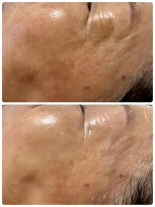 Lien オーナー　山口智嘉のエステ・リラクイメージ