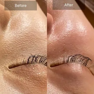 Mandarin Orange所属・毛穴から始める肌メン テマンダリンオレンジのエステ・リラクイメージ