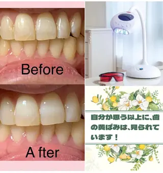 整体フェイシャル EMINALのエステ・リラクイメージ