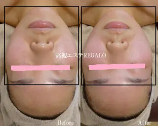 REGALO所属・矢野 さやかのエステ・リラクイメージ