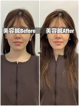 メディカルサロンドオフ所属・ハリサロンドオフ 美容鍼灸×小顔整体のエステ・リラクイメージ