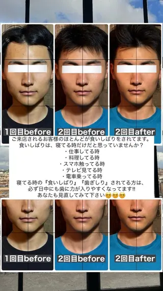 💎後悔させない小顔 矯正💎イトヤマ🌱のエステ・リラクイメージ