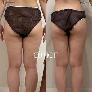 aimer所属・aimer 島田のエステ・リラクイメージ