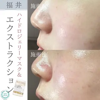 毛穴ケア専門サロン Yourmeユアミーのエステ・リラクイメージ