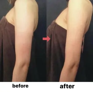 横浜エステサロン R-ing リングのエステ・リラクイメージ