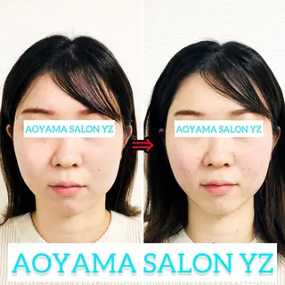 小顔美容鍼専門サロン 渋谷YZのエステ・リラクイメージ