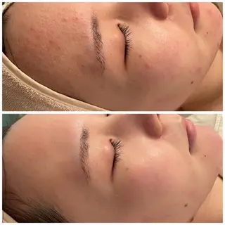 ✨美肌水光✨ アトリエリュバンのエステ・リラクイメージ