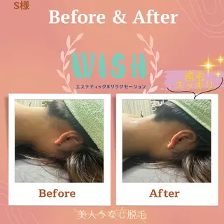 WISH 美肌脱毛のプロ！須藤のエステ・リラクイメージ