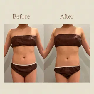 お腹痩せエステ Flat BELLY 恵比寿所属・【腸もみ/脂肪冷却】 お腹エステ/恵比寿のエステ・リラクイメージ