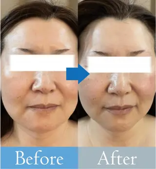 美肌/小顔/眉毛の 専門店 ルミナスの眉毛・アイブロウイメージ