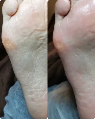 ネイル ROUN' 齋藤のエステ・リラクイメージ