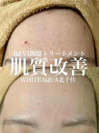 WHITE AQUA 北千住店のエステ・リラクイメージ