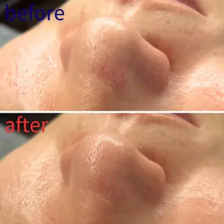 毛穴洗浄特化🫧 オオツカのエステ・リラクイメージ