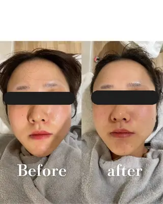 メンズ 高岳/久屋大通　脱毛 コルギ🌿ENSHIのエステ・リラクイメージ