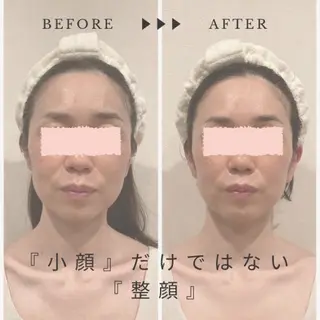 小顔×肌質改善サロン soin〔ソワン〕のエステ・リラクイメージ