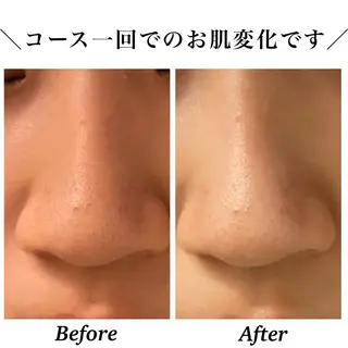 Bellesthe (ベルエステ)のエステ・リラクイメージ