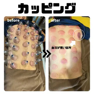 鍼灸院楽々館所属・宇田 碧のエステ・リラクイメージ