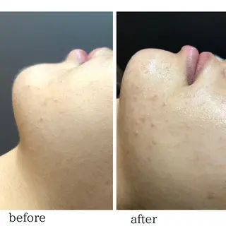 Naps-Shaving所属・敏感肌⭐️ シェービング専門佐藤の眉毛・アイブロウイメージ