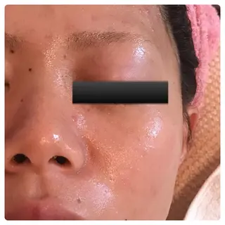 フェアリーローズ所属・fairyrose organicエステのエステ・リラクイメージ