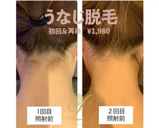 Beauty  salon Lino所属・美肌特化の イオン導入脱毛のエステ・リラクイメージ