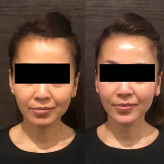 サロンドゥ ルシエルのエステ・リラクイメージ