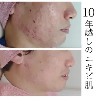 ユニセックスエステサロンUniclear所属・男女エステ ユニクリアのエステ・リラクイメージ