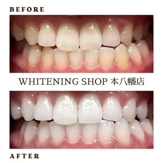 メンズ ホワイトニング ショップ本八幡店のエステ・リラクイメージ